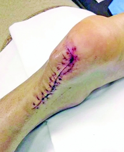 �����˿ڲ��� �׶Ȼ�Ӧ“��ˤ”